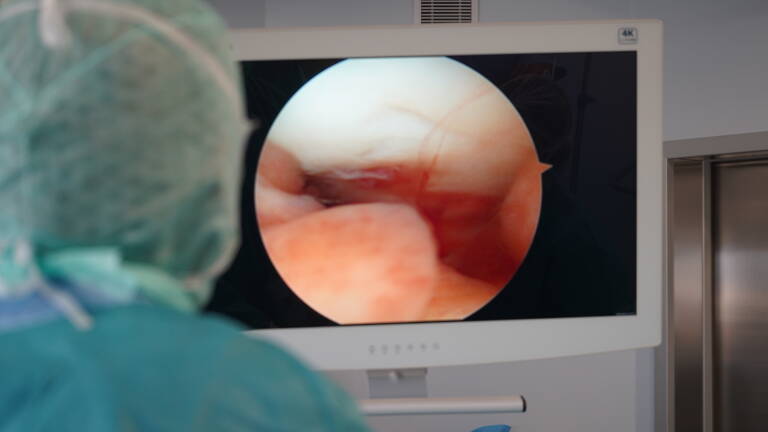 La artroscopia incorpora una cámara que permite ver el interior de la cadera con una mínima incisión