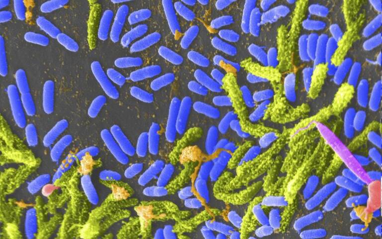 Bacteria Vibrio (Azul) que puede causar cólera. Foto: TINA CARVALHO, UNIVERSIDAD DE HAWAII EN MANOA